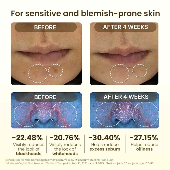 Glow Mist Serum, Propolis 20,000 ppm, Niacinamide 5%, Hyaluronic Acid, Hydrating Face Mist, Lightweight Serum, Non-Comedogenic, For Sensitive Skin, Korean Skin Care (2.70 fl oz)